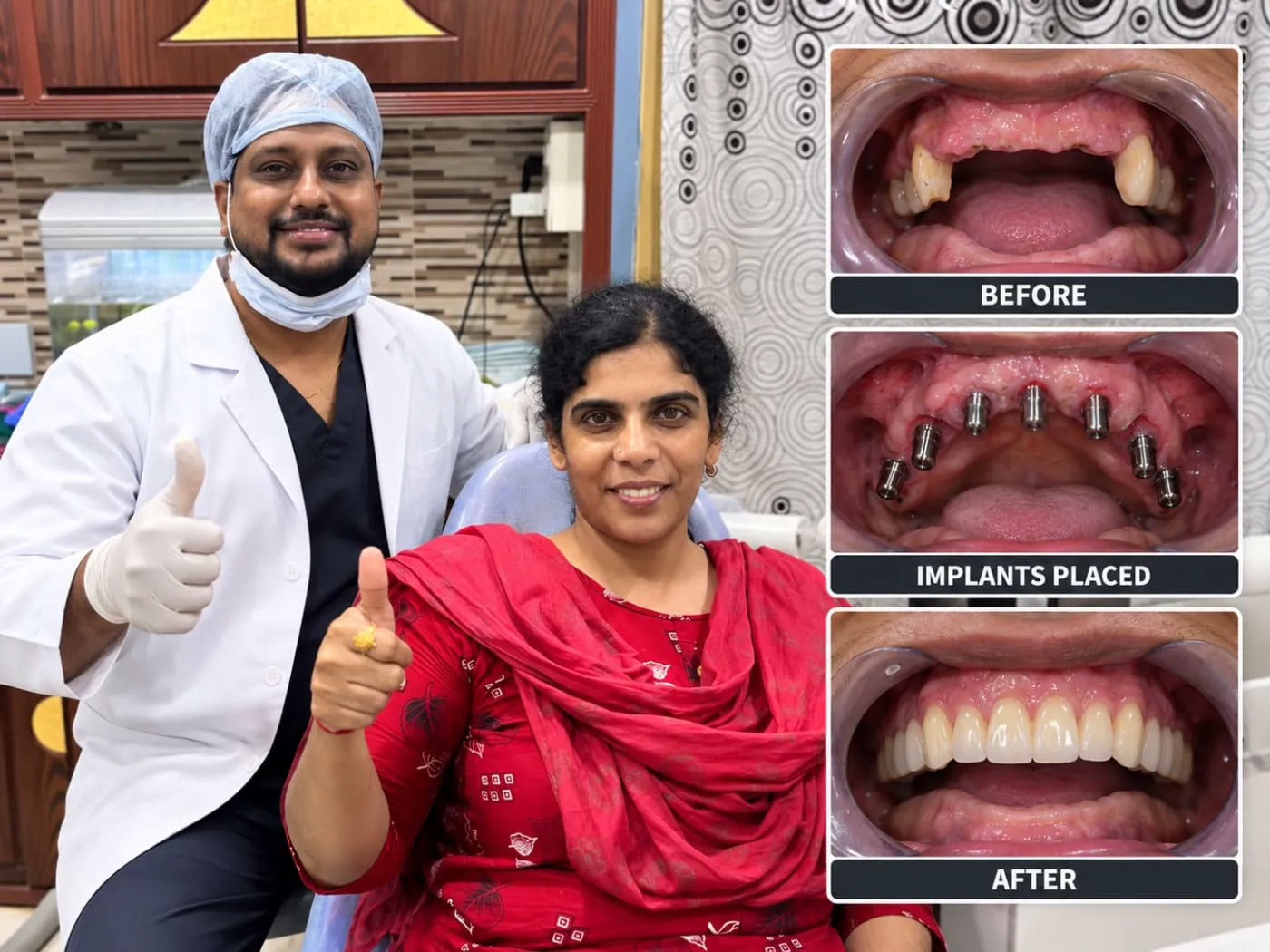Dental Implants