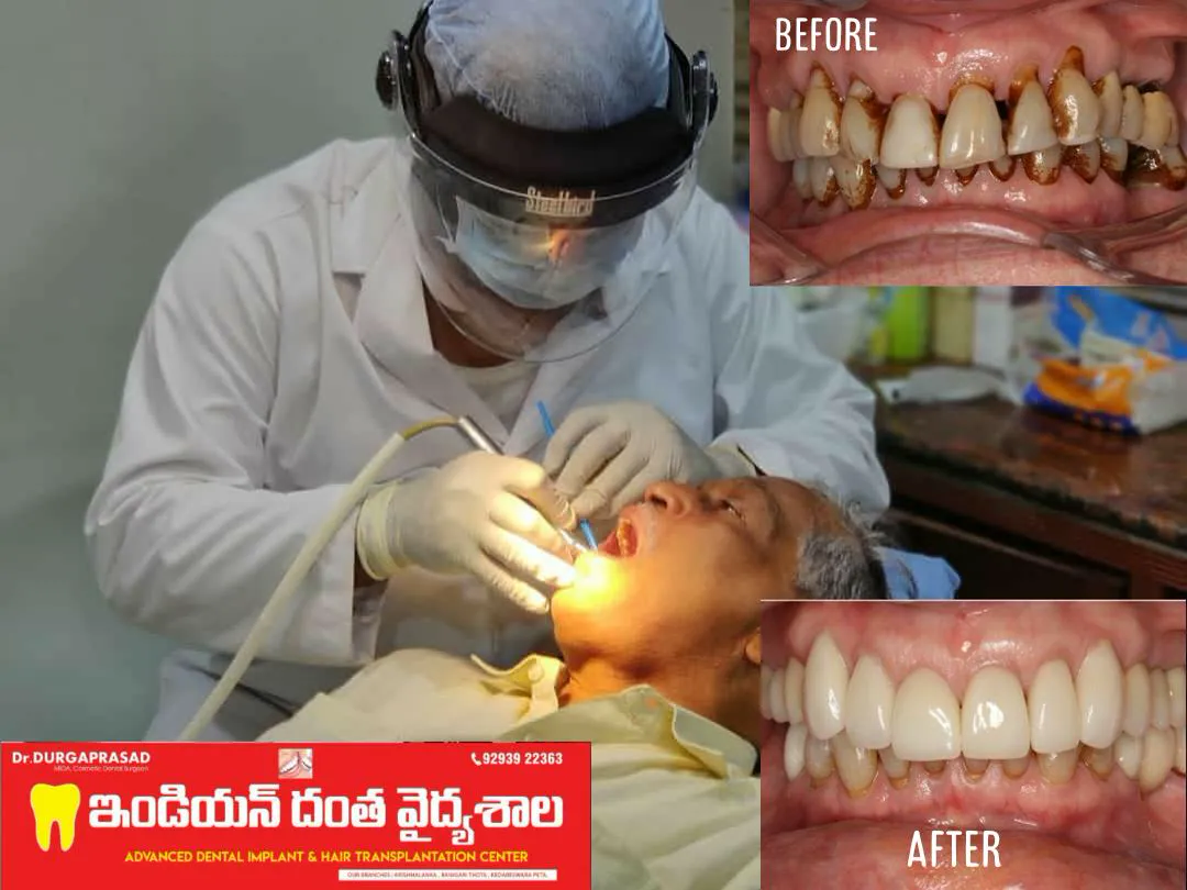 Cosmetic Dentistry